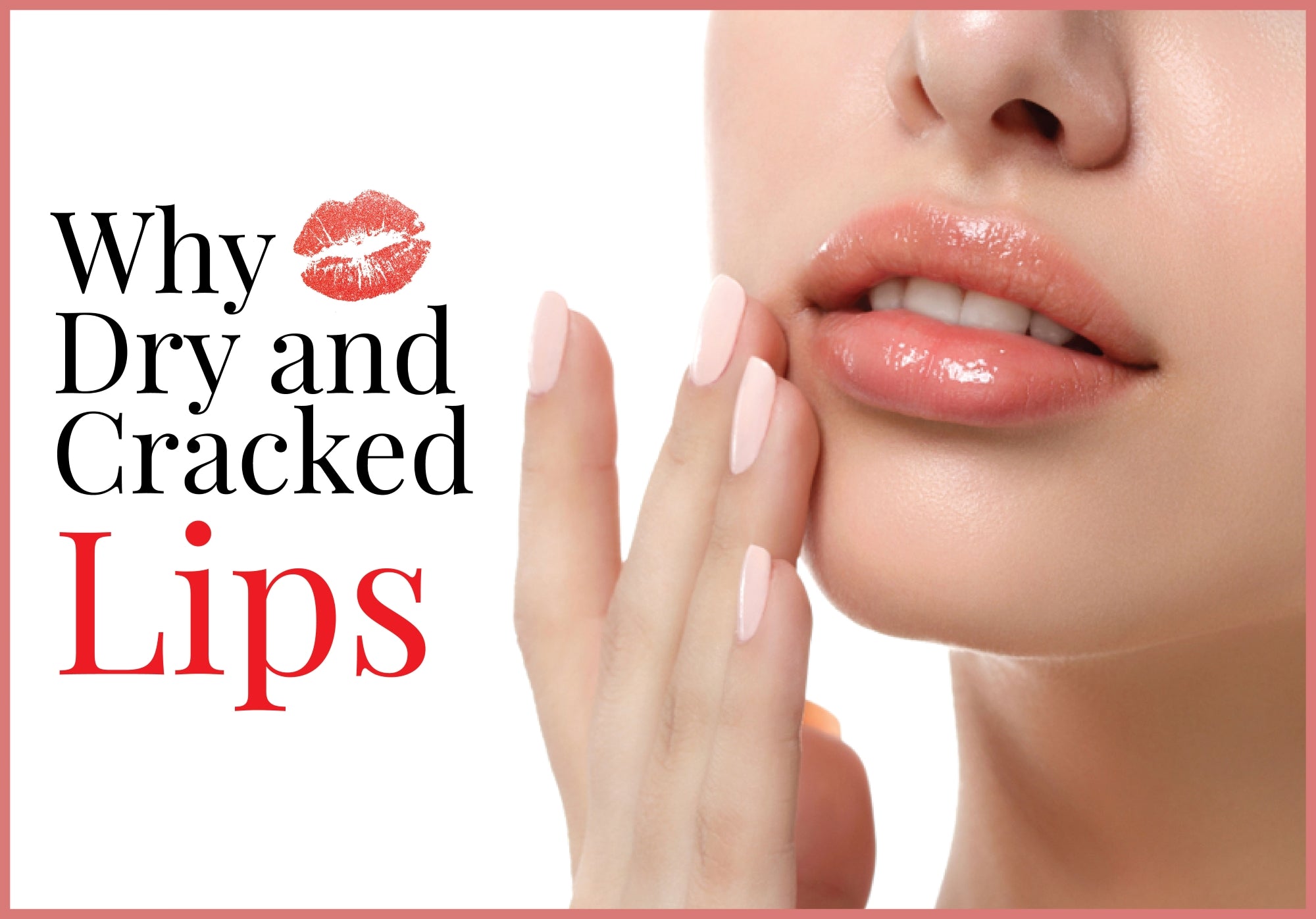 Cracked and Dry Lips – Sunway Multicare Pharmacy